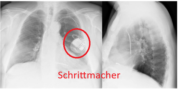 Antwort